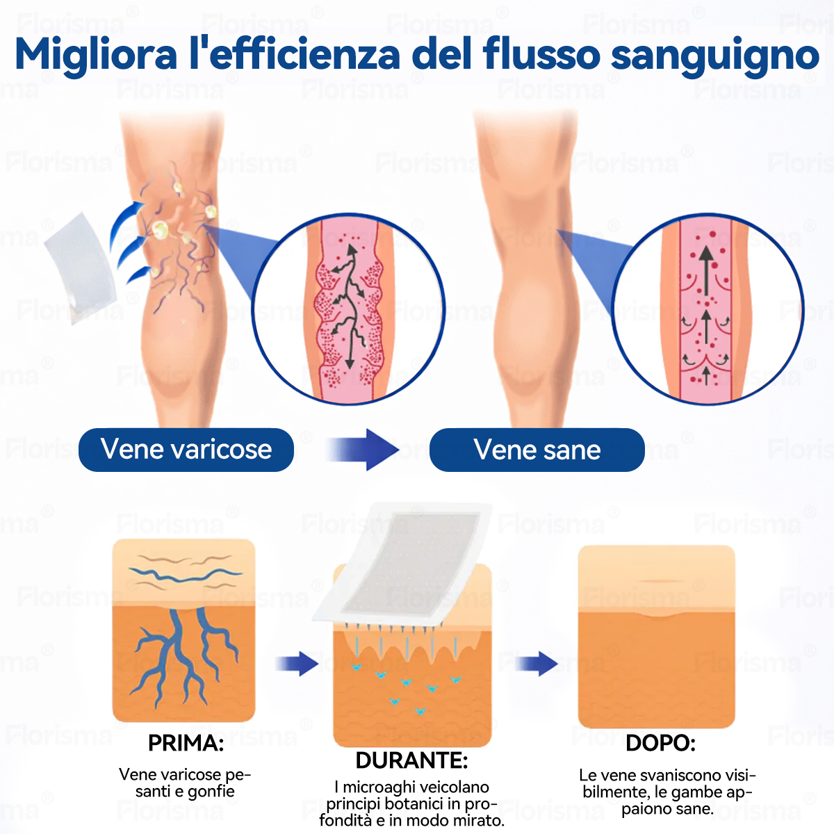🛡️ 𝑭𝑳𝑶𝑹𝑰𝑺𝑴𝑨® 🎉 Cerotto Microneedle di Grado Clinico (con Diosmina ed Esperidina) — Progettato specificamente per contrastare i capillari visibili e le vene varicose, aiutando al contempo ad alleviare la sensazione di gambe pesanti e affaticate. 👩‍⚕️