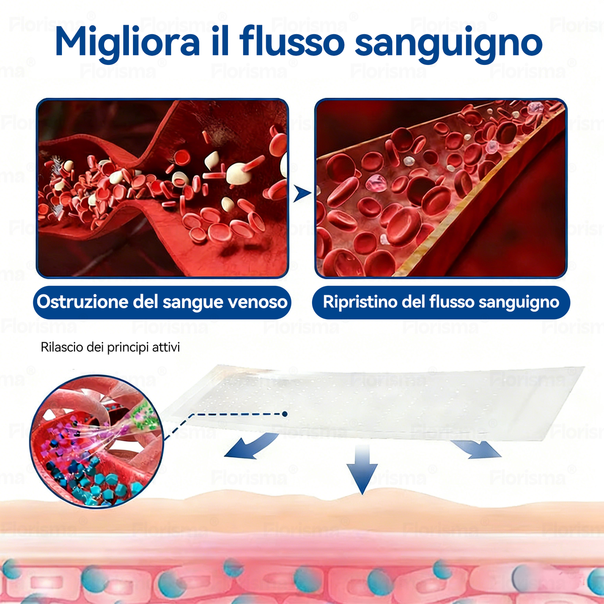 𝑭𝑳𝑶𝑹𝑰𝑺𝑴𝑨®  Cerotto Microneedle di Grado Clinico (con Diosmina ed Esperidina)🎁🎁