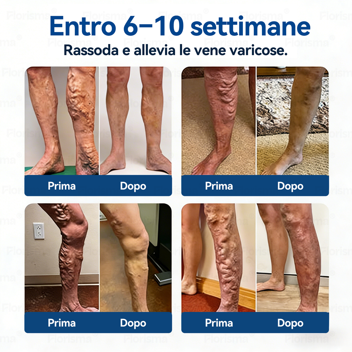 𝑭𝑳𝑶𝑹𝑰𝑺𝑴𝑨®  Cerotto Microneedle di Grado Clinico (con Diosmina ed Esperidina)🎁🎁