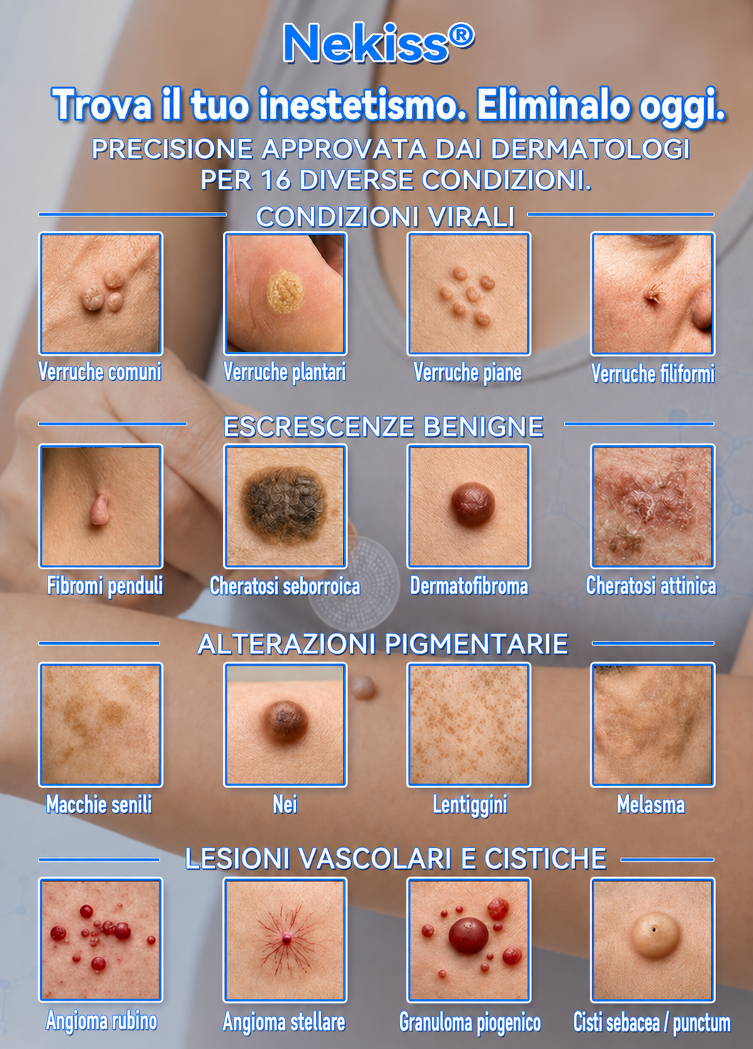 🎉👩🏻‍⚕️ 𝑁𝑒𝑔𝑜𝑧𝑖𝑜 𝑈𝑓𝑓𝑖𝑐𝑖𝑎𝑙𝑒 | 𝑵𝐞𝒌𝐢𝐬𝐬® 🌿 𝑀𝑖𝑐𝑟𝑜𝑎𝑔ℎ𝑖 𝑃𝑒𝑙𝑙𝑒 𝑃𝑒𝑟𝑓𝑒𝑡𝑡𝑎 𝑅𝑖𝑚𝑜𝑧𝑖𝑜𝑛𝑒 𝐷𝑒𝑙𝑙𝑒 𝑉𝑒𝑟𝑟𝑢𝑐ℎ𝑒 𝐶𝑒𝑟𝑜𝑡𝑡𝑜 (𝑃𝑜𝑢𝑟 𝑙𝑒𝑠 é𝑡𝑖𝑞𝑢𝑒𝑡𝑡𝑒𝑠 𝑐𝑢𝑡𝑎𝑛é𝑒𝑠, 𝑙𝑒𝑠 𝑝𝑒𝑡𝑖𝑡𝑒𝑠 𝑒𝑥𝑐𝑟𝑜𝑖𝑠𝑠𝑎𝑛𝑐𝑒𝑠 𝑐𝑢𝑡𝑎𝑛é𝑒𝑠, 𝑙𝑒𝑠 𝑣𝑒𝑟𝑟𝑢𝑒𝑠, 𝑙𝑒𝑠 𝑔𝑟𝑎𝑖𝑛𝑠 𝑑𝑒 𝑏𝑒𝑎𝑢𝑡é, 𝑙𝑒𝑠 𝑡𝑎𝑐ℎ𝑒𝑠 𝑑𝑒 𝑣𝑖𝑒𝑖𝑙𝑙𝑒𝑠𝑠𝑒 𝑒𝑡 𝑙𝑒𝑠 𝑝𝑟𝑜𝑏𝑙è𝑚𝑒𝑠 𝑑𝑒 𝑝𝑖𝑔𝑚𝑒𝑛𝑡𝑎𝑡𝑖𝑜𝑛)
