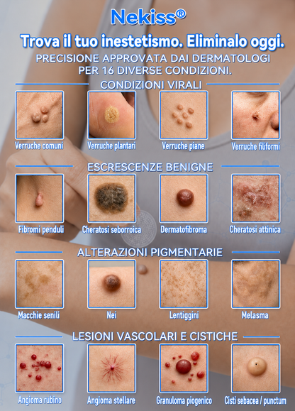 🎉👩🏻‍⚕️ 𝑁𝑒𝑔𝑜𝑧𝑖𝑜 𝑈𝑓𝑓𝑖𝑐𝑖𝑎𝑙𝑒 | 𝑵𝐞𝒌𝐢𝐬𝐬® 🌿 𝑀𝑖𝑐𝑟𝑜𝑎𝑔ℎ𝑖 𝑃𝑒𝑙𝑙𝑒 𝑃𝑒𝑟𝑓𝑒𝑡𝑡𝑎 𝑅𝑖𝑚𝑜𝑧𝑖𝑜𝑛𝑒 𝐷𝑒𝑙𝑙𝑒 𝑉𝑒𝑟𝑟𝑢𝑐ℎ𝑒 𝐶𝑒𝑟𝑜𝑡𝑡𝑜 (𝑃𝑜𝑢𝑟 𝑙𝑒𝑠 é𝑡𝑖𝑞𝑢𝑒𝑡𝑡𝑒𝑠 𝑐𝑢𝑡𝑎𝑛é𝑒𝑠, 𝑙𝑒𝑠 𝑝𝑒𝑡𝑖𝑡𝑒𝑠 𝑒𝑥𝑐𝑟𝑜𝑖𝑠𝑠𝑎𝑛𝑐𝑒𝑠 𝑐𝑢𝑡𝑎𝑛é𝑒𝑠, 𝑙𝑒𝑠 𝑣𝑒𝑟𝑟𝑢𝑒𝑠, 𝑙𝑒𝑠 𝑔𝑟𝑎𝑖𝑛𝑠 𝑑𝑒 𝑏𝑒𝑎𝑢𝑡é, 𝑙𝑒𝑠 𝑡𝑎𝑐ℎ𝑒𝑠 𝑑𝑒 𝑣𝑖𝑒𝑖𝑙𝑙𝑒𝑠𝑠𝑒 𝑒𝑡 𝑙𝑒𝑠 𝑝𝑟𝑜𝑏𝑙è𝑚𝑒𝑠 𝑑𝑒 𝑝𝑖𝑔𝑚𝑒𝑛𝑡𝑎𝑡𝑖𝑜𝑛)