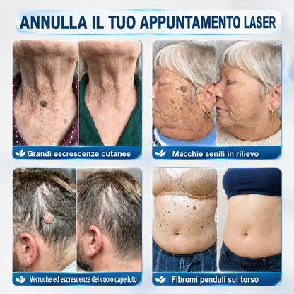 🎉👩🏻‍⚕️ 𝑁𝑒𝑔𝑜𝑧𝑖𝑜 𝑈𝑓𝑓𝑖𝑐𝑖𝑎𝑙𝑒 | 𝑵𝐞𝒌𝐢𝐬𝐬® 🌿 𝑀𝑖𝑐𝑟𝑜𝑎𝑔ℎ𝑖 𝑃𝑒𝑙𝑙𝑒 𝑃𝑒𝑟𝑓𝑒𝑡𝑡𝑎 𝑅𝑖𝑚𝑜𝑧𝑖𝑜𝑛𝑒 𝐷𝑒𝑙𝑙𝑒 𝑉𝑒𝑟𝑟𝑢𝑐ℎ𝑒 𝐶𝑒𝑟𝑜𝑡𝑡𝑜 (𝑃𝑜𝑢𝑟 𝑙𝑒𝑠 é𝑡𝑖𝑞𝑢𝑒𝑡𝑡𝑒𝑠 𝑐𝑢𝑡𝑎𝑛é𝑒𝑠, 𝑙𝑒𝑠 𝑝𝑒𝑡𝑖𝑡𝑒𝑠 𝑒𝑥𝑐𝑟𝑜𝑖𝑠𝑠𝑎𝑛𝑐𝑒𝑠 𝑐𝑢𝑡𝑎𝑛é𝑒𝑠, 𝑙𝑒𝑠 𝑣𝑒𝑟𝑟𝑢𝑒𝑠, 𝑙𝑒𝑠 𝑔𝑟𝑎𝑖𝑛𝑠 𝑑𝑒 𝑏𝑒𝑎𝑢𝑡é, 𝑙𝑒𝑠 𝑡𝑎𝑐ℎ𝑒𝑠 𝑑𝑒 𝑣𝑖𝑒𝑖𝑙𝑙𝑒𝑠𝑠𝑒 𝑒𝑡 𝑙𝑒𝑠 𝑝𝑟𝑜𝑏𝑙è𝑚𝑒𝑠 𝑑𝑒 𝑝𝑖𝑔𝑚𝑒𝑛𝑡𝑎𝑡𝑖𝑜𝑛)
