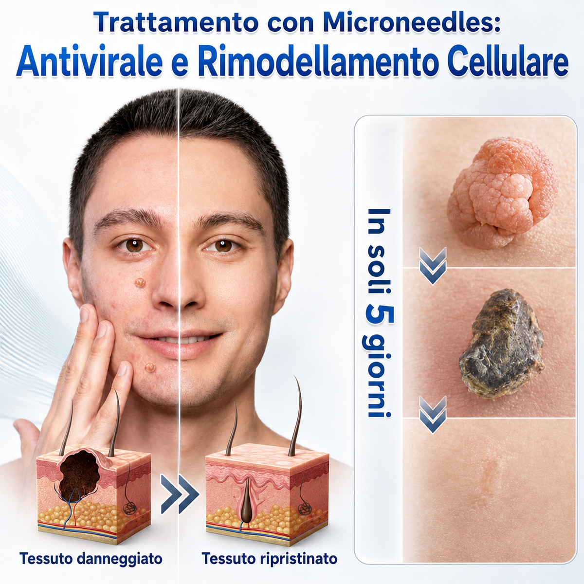🎉👩🏻‍⚕️ 𝑁𝑒𝑔𝑜𝑧𝑖𝑜 𝑈𝑓𝑓𝑖𝑐𝑖𝑎𝑙𝑒 | 𝑵𝐞𝒌𝐢𝐬𝐬® 🌿 𝑀𝑖𝑐𝑟𝑜𝑎𝑔ℎ𝑖 𝑃𝑒𝑙𝑙𝑒 𝑃𝑒𝑟𝑓𝑒𝑡𝑡𝑎 𝑅𝑖𝑚𝑜𝑧𝑖𝑜𝑛𝑒 𝐷𝑒𝑙𝑙𝑒 𝑉𝑒𝑟𝑟𝑢𝑐ℎ𝑒 𝐶𝑒𝑟𝑜𝑡𝑡𝑜 (𝑃𝑜𝑢𝑟 𝑙𝑒𝑠 é𝑡𝑖𝑞𝑢𝑒𝑡𝑡𝑒𝑠 𝑐𝑢𝑡𝑎𝑛é𝑒𝑠, 𝑙𝑒𝑠 𝑝𝑒𝑡𝑖𝑡𝑒𝑠 𝑒𝑥𝑐𝑟𝑜𝑖𝑠𝑠𝑎𝑛𝑐𝑒𝑠 𝑐𝑢𝑡𝑎𝑛é𝑒𝑠, 𝑙𝑒𝑠 𝑣𝑒𝑟𝑟𝑢𝑒𝑠, 𝑙𝑒𝑠 𝑔𝑟𝑎𝑖𝑛𝑠 𝑑𝑒 𝑏𝑒𝑎𝑢𝑡é, 𝑙𝑒𝑠 𝑡𝑎𝑐ℎ𝑒𝑠 𝑑𝑒 𝑣𝑖𝑒𝑖𝑙𝑙𝑒𝑠𝑠𝑒 𝑒𝑡 𝑙𝑒𝑠 𝑝𝑟𝑜𝑏𝑙è𝑚𝑒𝑠 𝑑𝑒 𝑝𝑖𝑔𝑚𝑒𝑛𝑡𝑎𝑡𝑖𝑜𝑛)