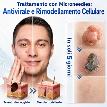 🎉👩🏻‍⚕️ 𝑁𝑒𝑔𝑜𝑧𝑖𝑜 𝑈𝑓𝑓𝑖𝑐𝑖𝑎𝑙𝑒 | 𝑵𝐞𝒌𝐢𝐬𝐬® 🌿 𝑀𝑖𝑐𝑟𝑜𝑎𝑔ℎ𝑖 𝑃𝑒𝑙𝑙𝑒 𝑃𝑒𝑟𝑓𝑒𝑡𝑡𝑎 𝑅𝑖𝑚𝑜𝑧𝑖𝑜𝑛𝑒 𝐷𝑒𝑙𝑙𝑒 𝑉𝑒𝑟𝑟𝑢𝑐ℎ𝑒 𝐶𝑒𝑟𝑜𝑡𝑡𝑜 (𝑃𝑜𝑢𝑟 𝑙𝑒𝑠 é𝑡𝑖𝑞𝑢𝑒𝑡𝑡𝑒𝑠 𝑐𝑢𝑡𝑎𝑛é𝑒𝑠, 𝑙𝑒𝑠 𝑝𝑒𝑡𝑖𝑡𝑒𝑠 𝑒𝑥𝑐𝑟𝑜𝑖𝑠𝑠𝑎𝑛𝑐𝑒𝑠 𝑐𝑢𝑡𝑎𝑛é𝑒𝑠, 𝑙𝑒𝑠 𝑣𝑒𝑟𝑟𝑢𝑒𝑠, 𝑙𝑒𝑠 𝑔𝑟𝑎𝑖𝑛𝑠 𝑑𝑒 𝑏𝑒𝑎𝑢𝑡é, 𝑙𝑒𝑠 𝑡𝑎𝑐ℎ𝑒𝑠 𝑑𝑒 𝑣𝑖𝑒𝑖𝑙𝑙𝑒𝑠𝑠𝑒 𝑒𝑡 𝑙𝑒𝑠 𝑝𝑟𝑜𝑏𝑙è𝑚𝑒𝑠 𝑑𝑒 𝑝𝑖𝑔𝑚𝑒𝑛𝑡𝑎𝑡𝑖𝑜𝑛)